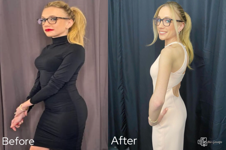 Kat-Timpf-Before-And-After-Weight-Loss